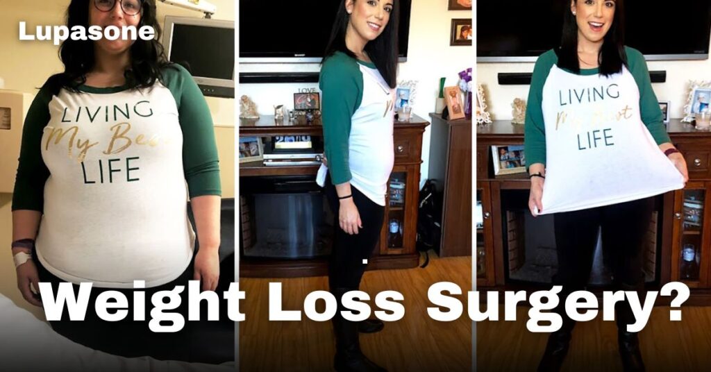 Weight Loss Surgery?